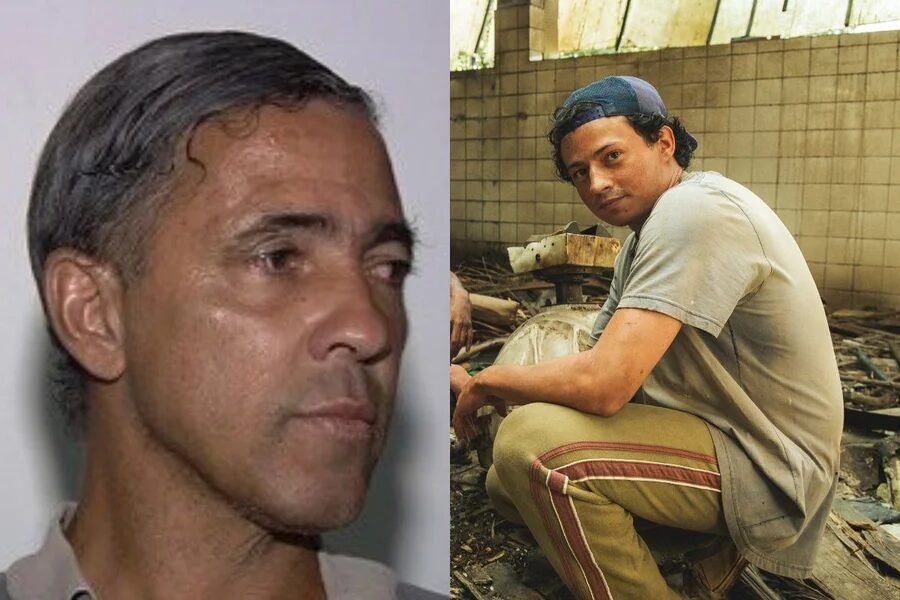 Cena de amputação em “Emergência Radioativa” aconteceu de verdade no caso Césio-137